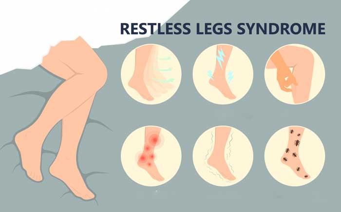 Синдром Restless legs