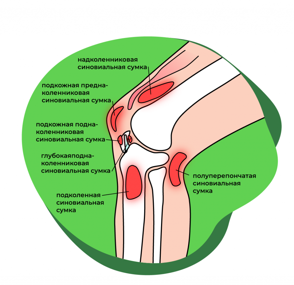 Боль в колене | причины, симптомы, диагностика, лечение и профилактика